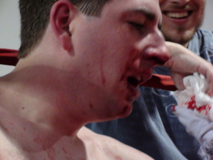Name:  barrys face.jpg
Views: 212
Size:  123.3 KB
