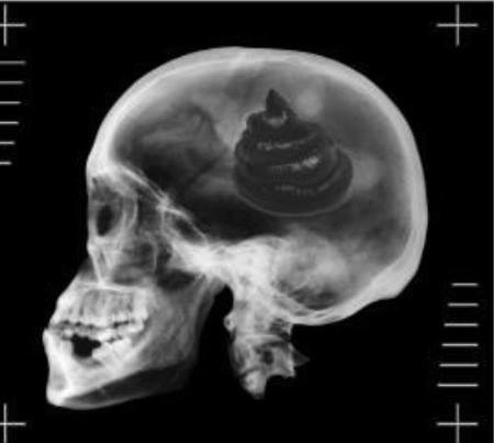 Name:  shitforbrains.jpg
Views: 614
Size:  15.3 KB
