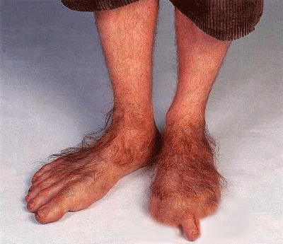 Name:  sixtoe.gif
Views: 277
Size:  79.3 KB