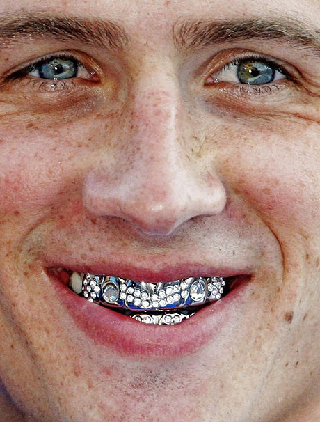 Name:  lochte_braces_2173884a.jpg
Views: 1365
Size:  114.3 KB