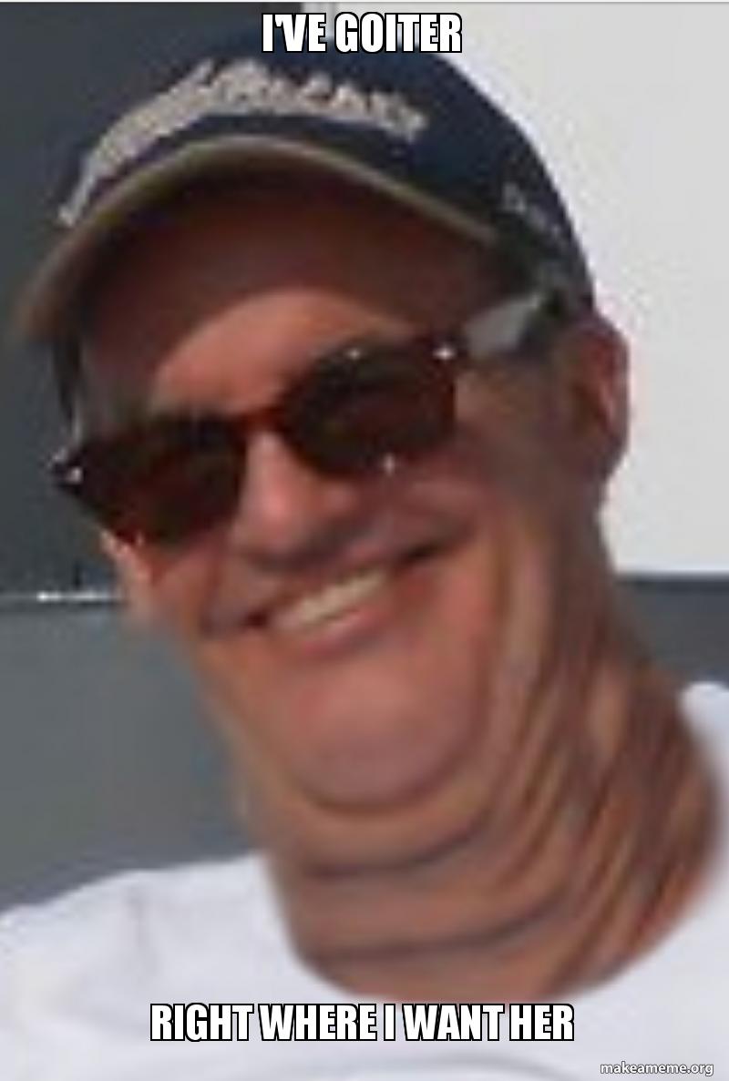 Name:  ive-goiter-right.jpg
Views: 291
Size:  54.6 KB
