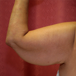 Name:  armskin (1).png
Views: 534
Size:  116.6 KB