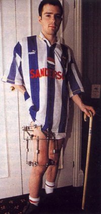 Name:  rivers leg brace.jpg
Views: 500
Size:  21.5 KB