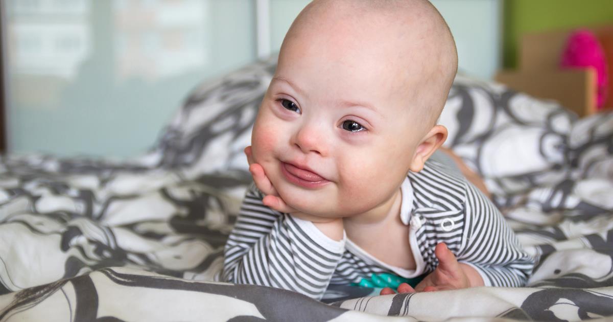Name:  down_syndrome_medical_conditions_affecting_children.jpg
Views: 222
Size:  70.3 KB