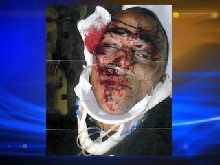 Name:  Alexander-Landau-Denver-Police-Beating-Lawsuit-Image-Victim-1--26482791_2893_ver1.0_320_240.jpg
Views: 346
Size:  12.9 KB