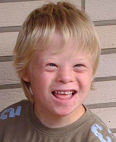 Name:  Down_Syndrome_child.jpg
Views: 1005
Size:  17.4 KB
