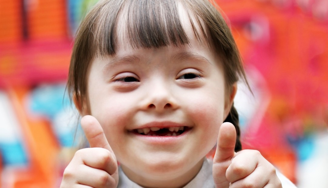 Name:  downs-syndrome.jpg
Views: 224
Size:  102.4 KB