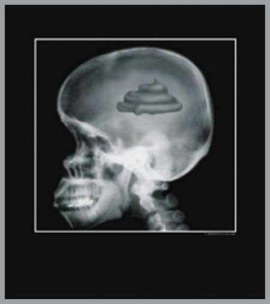 Name:  shit-brain1.jpg
Views: 364
Size:  69.7 KB