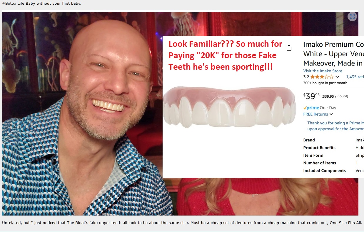 Name:  ChrissyVeneers.jpg
Views: 174
Size:  305.7 KB